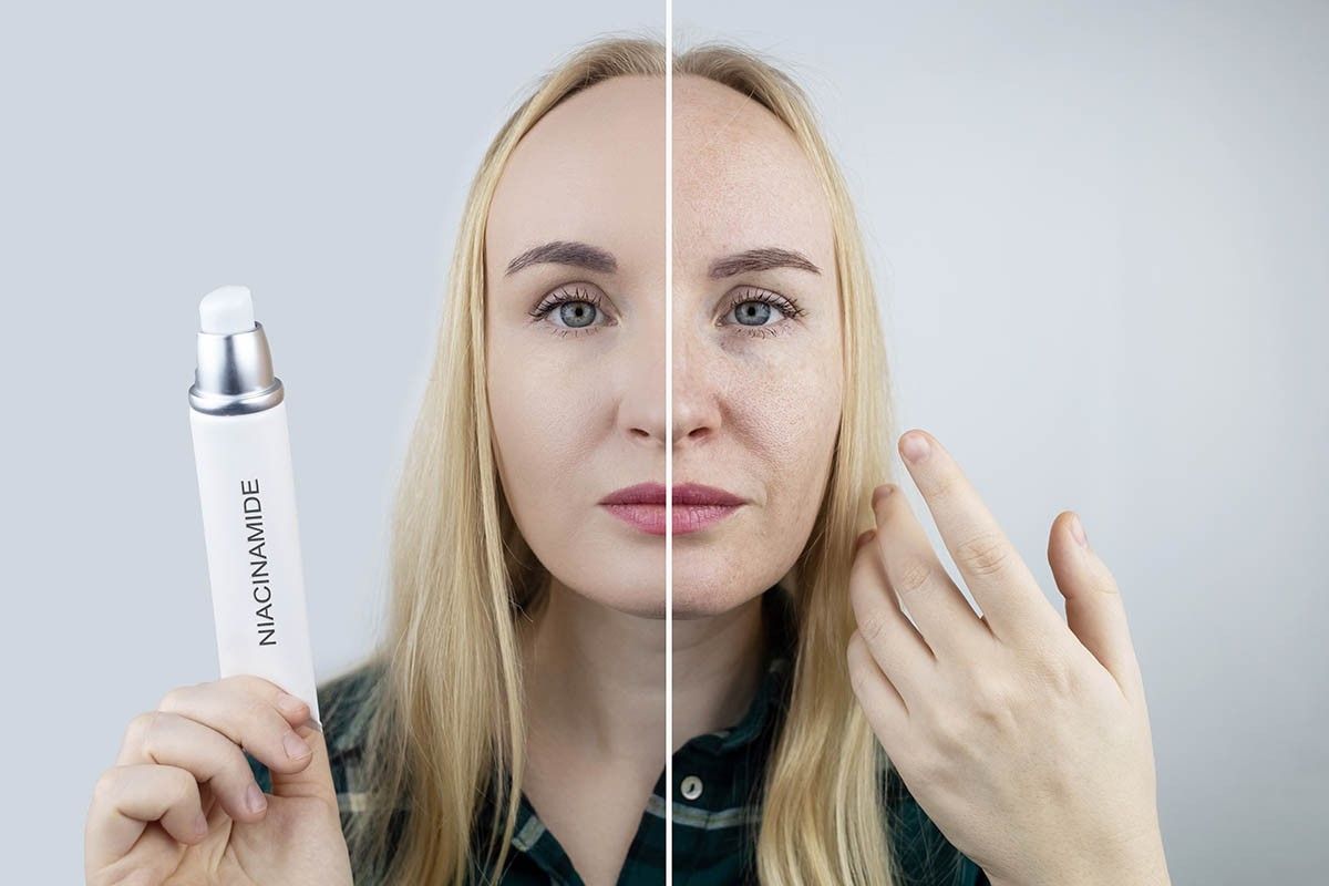 средства с ниацинамидом
