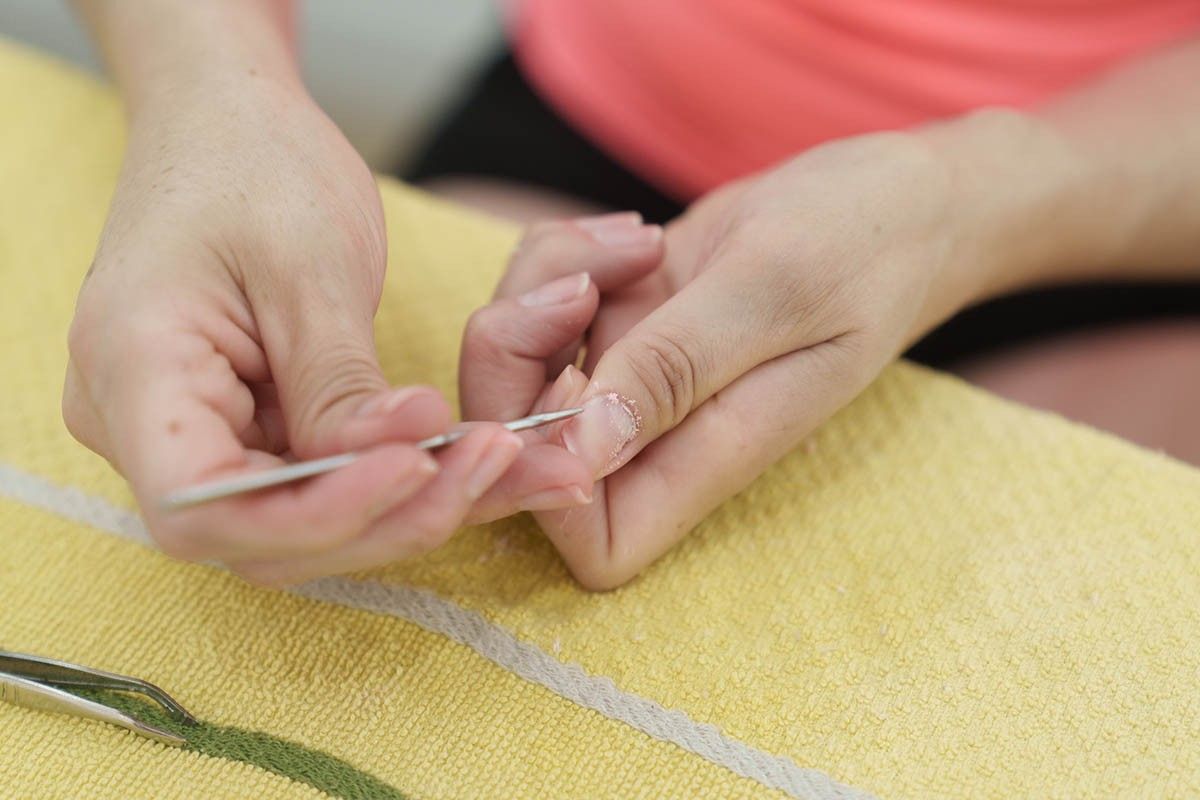 слоятся ногти у женщины